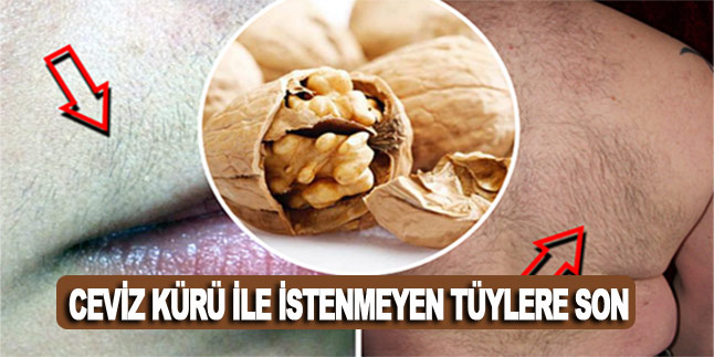 Ceviz Kürü İle İstenmeyen Tüylere Son!