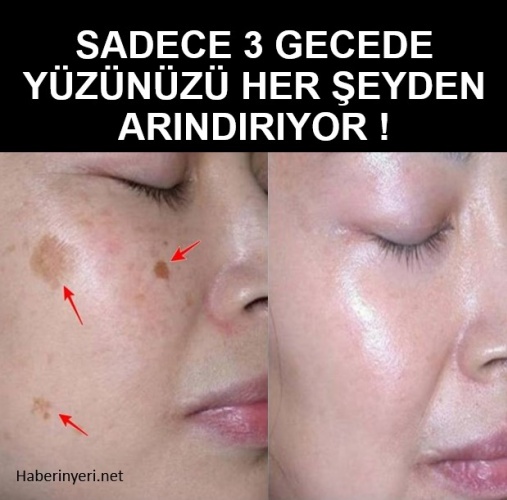 Sadece Üç Gecede Yüzünüzü Her Şeyden Arındıran Maske