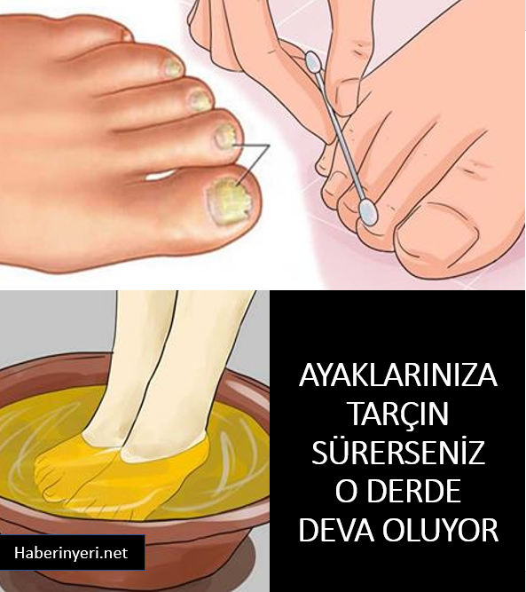 Ayaklarınıza Tarçın Sürerseniz Bakın Ne Oluyor