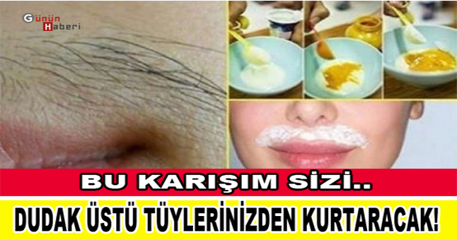 Bu Karışım Sizi Dudak Üstü Tüylerinizden Kurtaracak!