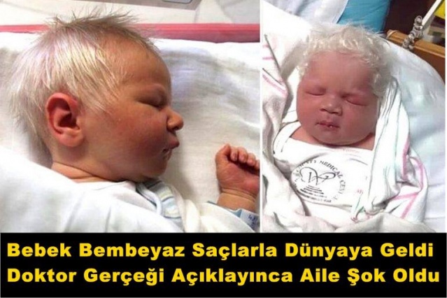 Bebek Bembeyaz Saçlarla Dünyaya Geldi Doktor Gerçeği Açıklayınca Aile Şok Oldu