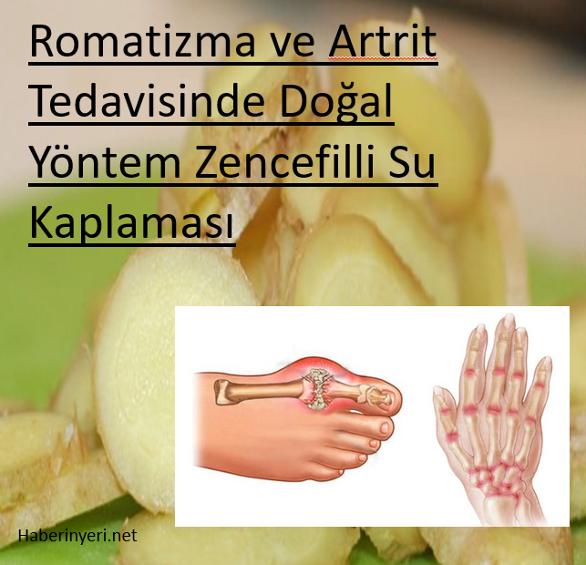 Romatizma ve Artrit Tedavisinde Doğal Yöntem Zencefilli Su Kaplaması