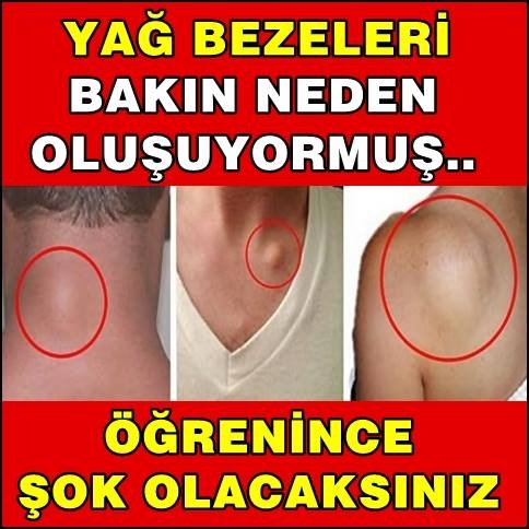 Öğrenince Şok Olacaksınız ! Bakın Yağ Bezeleri Neden Oluyormuş