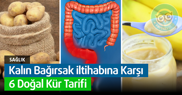 Kalın Bağırsak İltihabına Karşı 6 Doğal Kür Tarifi