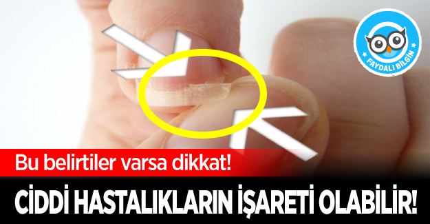 Bu belirtiler varsa dikkat! Ciddi hastalıkları işareti olabilir