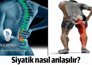 Siyatik ağrısı nasıl geçer Tedavi için doğal kürler