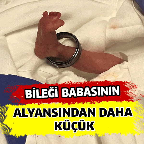 Bileği Alyanstan Daha Küçük