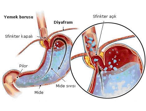 Eğer Bu Belirtiler Sizde De Varsa O Hastalığa Sahip Olabilirsiniz Dikkat