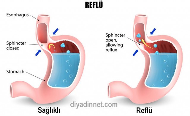 Eğer Bu Belirtiler Sizde De Varsa O Hastalığa Sahip Olabilirsiniz Dikkat