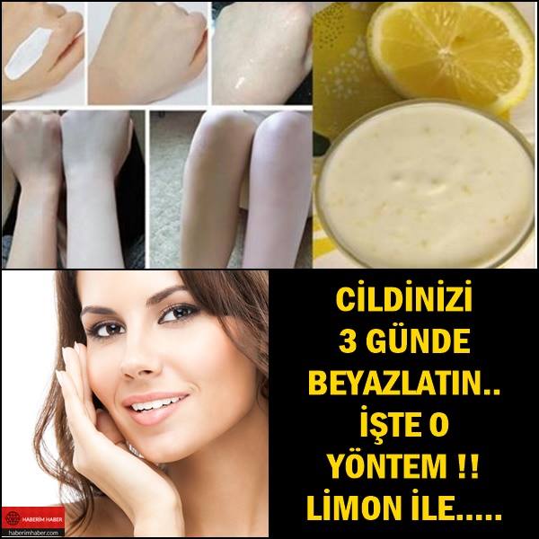 Cildinizi 3 Günde Limon İle Beyazlatabilirsiniz İşte O Formül