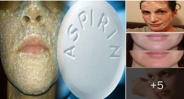 Aspirinin Ciltteki Mucizevi Etkisi