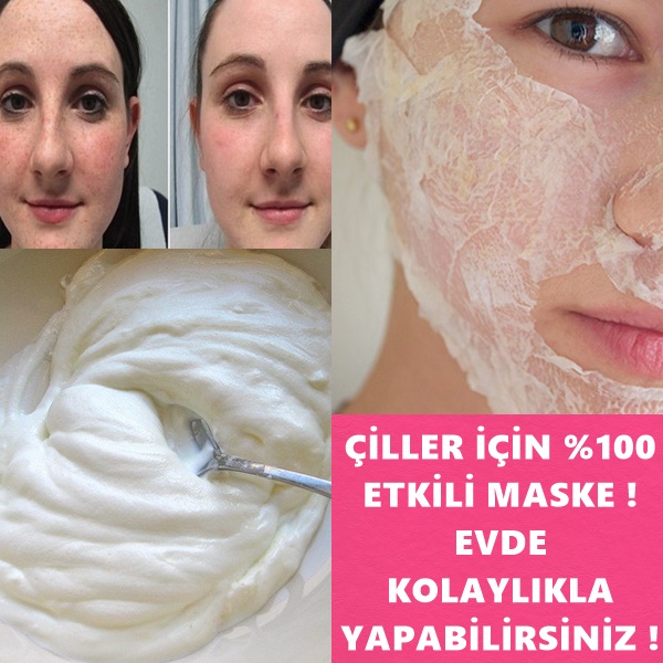 Çiller İçin Etkili Maske Evde Kolaylıkla yapabilirsiniz