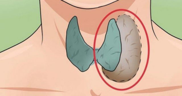Tiroid Probleminize Doğal Çözüm