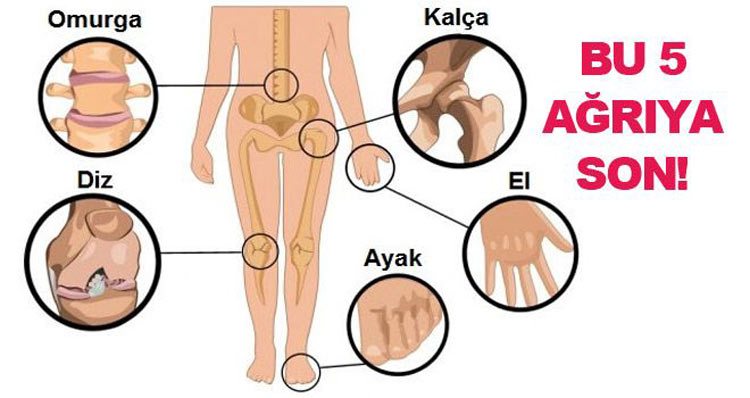 Eklem Ağrılarına 5 Denenmiş Çözüm