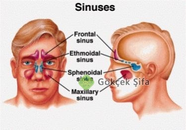 Sinüzit Ve Migren Ağrılarına Son Çözümü Bu Kadar Kolaymış
