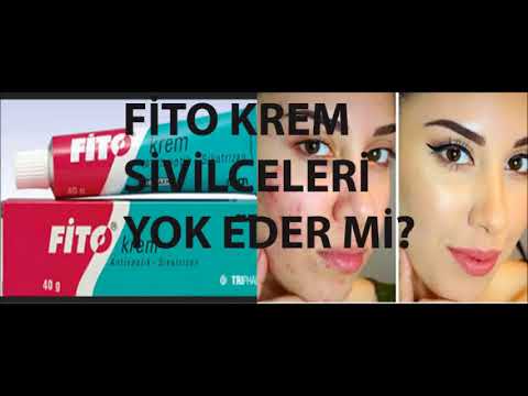 Fito Krem Hakkında Tüm Merak Ettiğiniz Soruların Cevapları