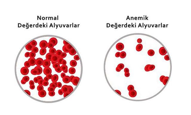 Eğer Sizde Kansızlık Çekiyorsanız ve Bir Türlü Değerleriniz Yükselmiyorsa…