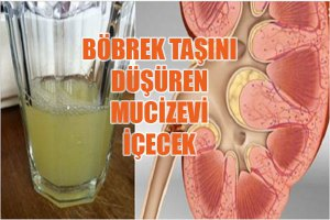 Böbrek Taşını Düşüren Doğal İçecek