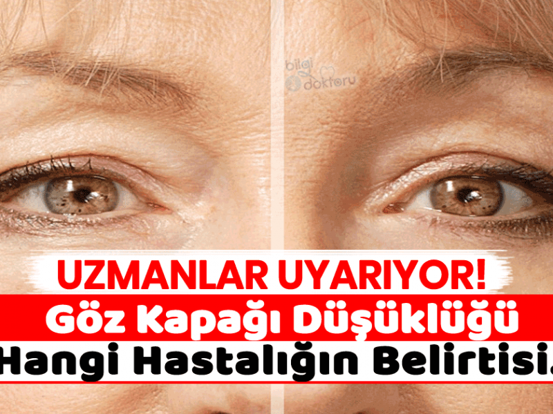 Göz Kapağı Düşüklüğü Ciddi Bir Sorunun Habercisi Olabilir