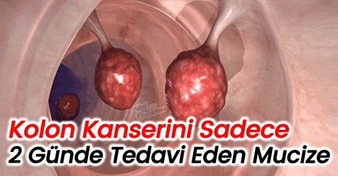 Kolon Kanserini Sadece 2 Günde Tedavi Eden Besin