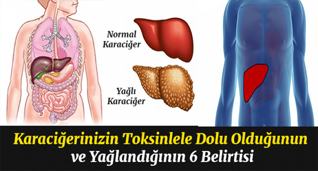 Karaciğerinizin Toksinlerle Dolu Olduğunu Gösteren 6 Belirti