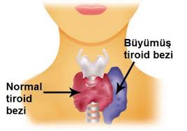 Tiroid Problemini Bitiren Doğal Çözüm