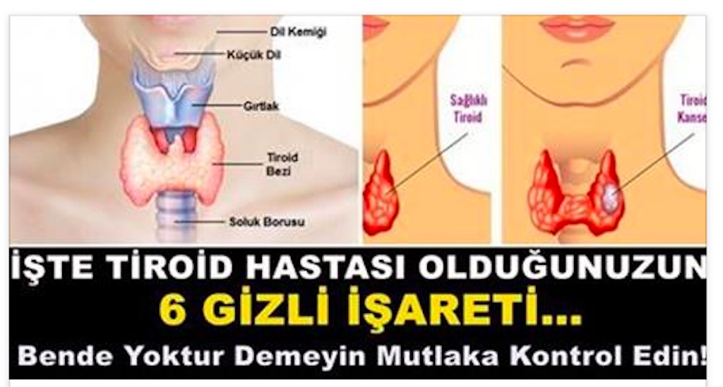 Tiroid Hastası Olduğunuzun 6 Gizli İşareti. Bende Yoktur Demeyin Mutlaka Kontrol Edin