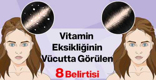 Vitamin Eksikliğinin Vücutta Görülen 8 Belirtisi